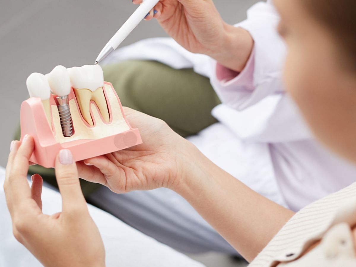 Implantes Dentários em Maceió e São Miguel dos Milagres Guia completo para recuperar o sorriso com segurança.